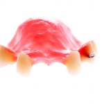 A set of acrylic dentures